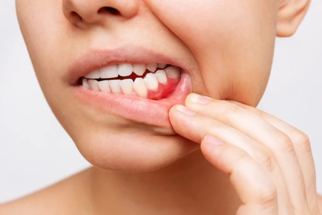 Periodontal Treatment in phoenix, AZ in phoenix, AZ | 24th Street Dental