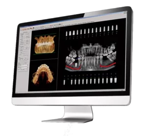 Dental imaging software showcasing panoramic and 3D jaw scans | 24th Street Dental in Phoenix, AZ