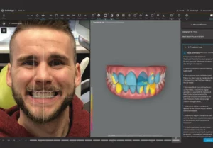Invisalign Smile Architect | 24th Street Dental in Phoenix, AZ