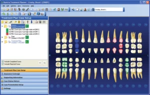 Treatment Planning Screen Shot | 24th Street Dental in Phoenix, AZ