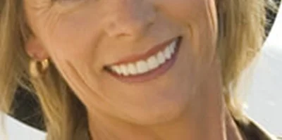 Close-up of teeth after treatment in Phoenix, AZ | 24th Street Dental Biltmore