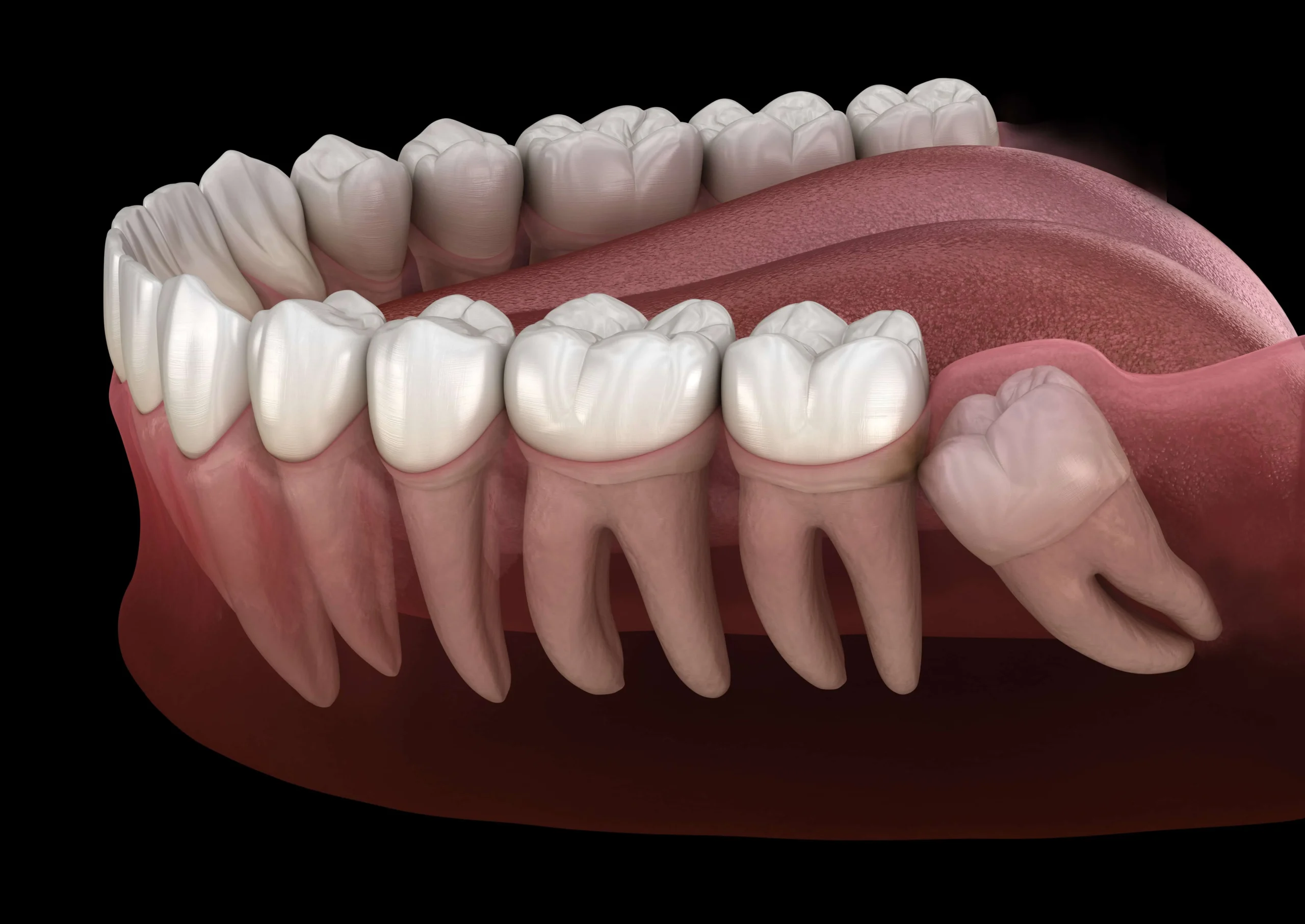 Dental implant procedure illustration | 24th Street Dental Biltmore in Phoenix, AZ