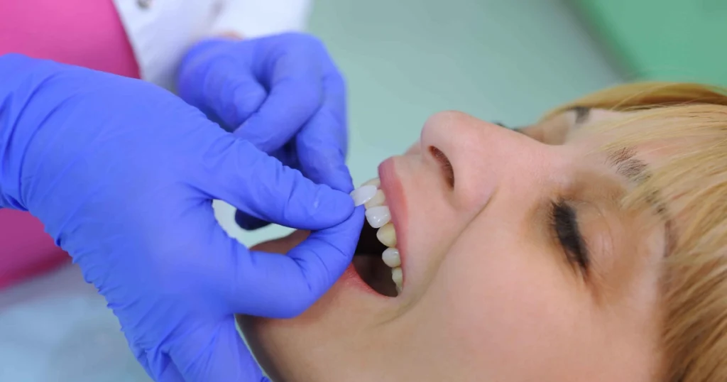 A dentist in Phoenix, AZ, holds a porcelain veneer near a patient’s mouth, checking fit or shade. Background is blurred, focus on the procedure.