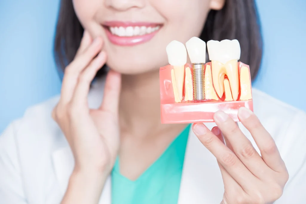 Dental Implant Tooth Model Display In Phoenix, AZ | 24th Street Dental Biltmore