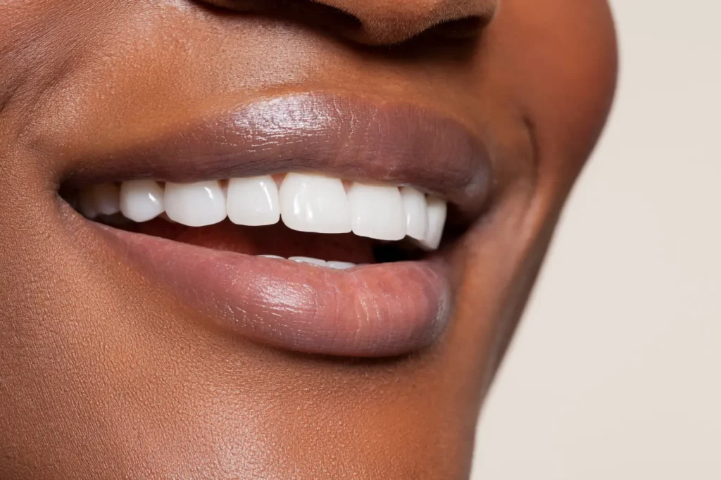 Close-up of healthy smile with white teeth and natural lips in Phoenix, AZ | 24th Street Dental Biltmore